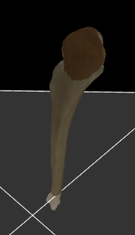 <p>Dorsale deel aan de bovenkant van de ulnae dat bij gestrekte elleboog in de fossa olecrani van de humerus past.</p>