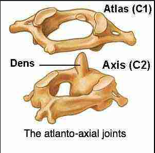 <p>The atlanto-axial joint is:</p>