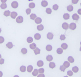 <p>What spreads Cytauxzoon felis&nbsp;</p>