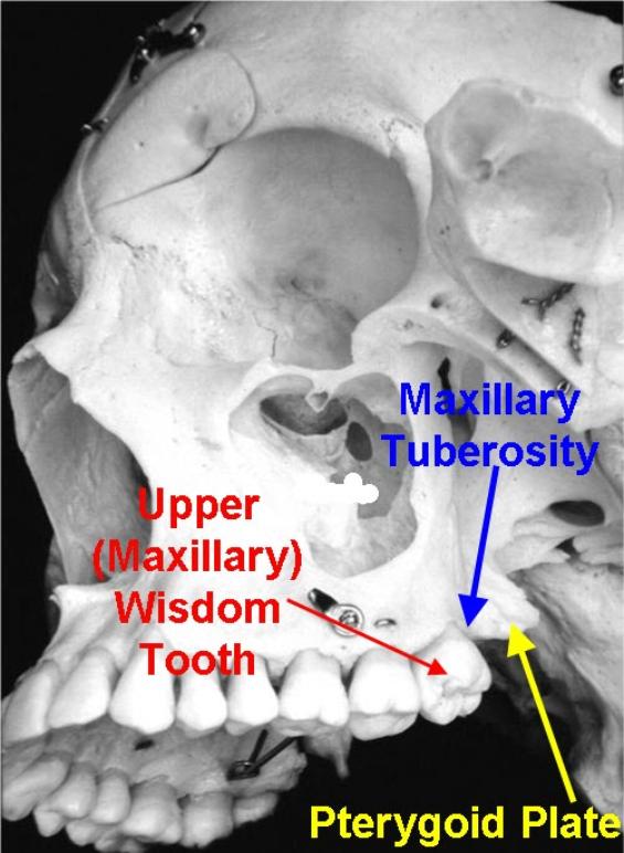 <ul><li><p>rounded bony process located in the posterior section of the alveolar maxilla ridge</p></li></ul><p></p>
