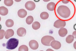 <p>Slightly elongated macrocytic RBC; width is not continuous</p><ul><li><p>Has to be bigger in size </p></li><li><p>Has to be oval shaped </p></li></ul><p></p>