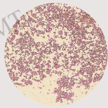 <p>stain, staining reaction, shape, arrangement in clusters </p>