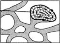 <p>What type of bone is seen in this picture?</p>