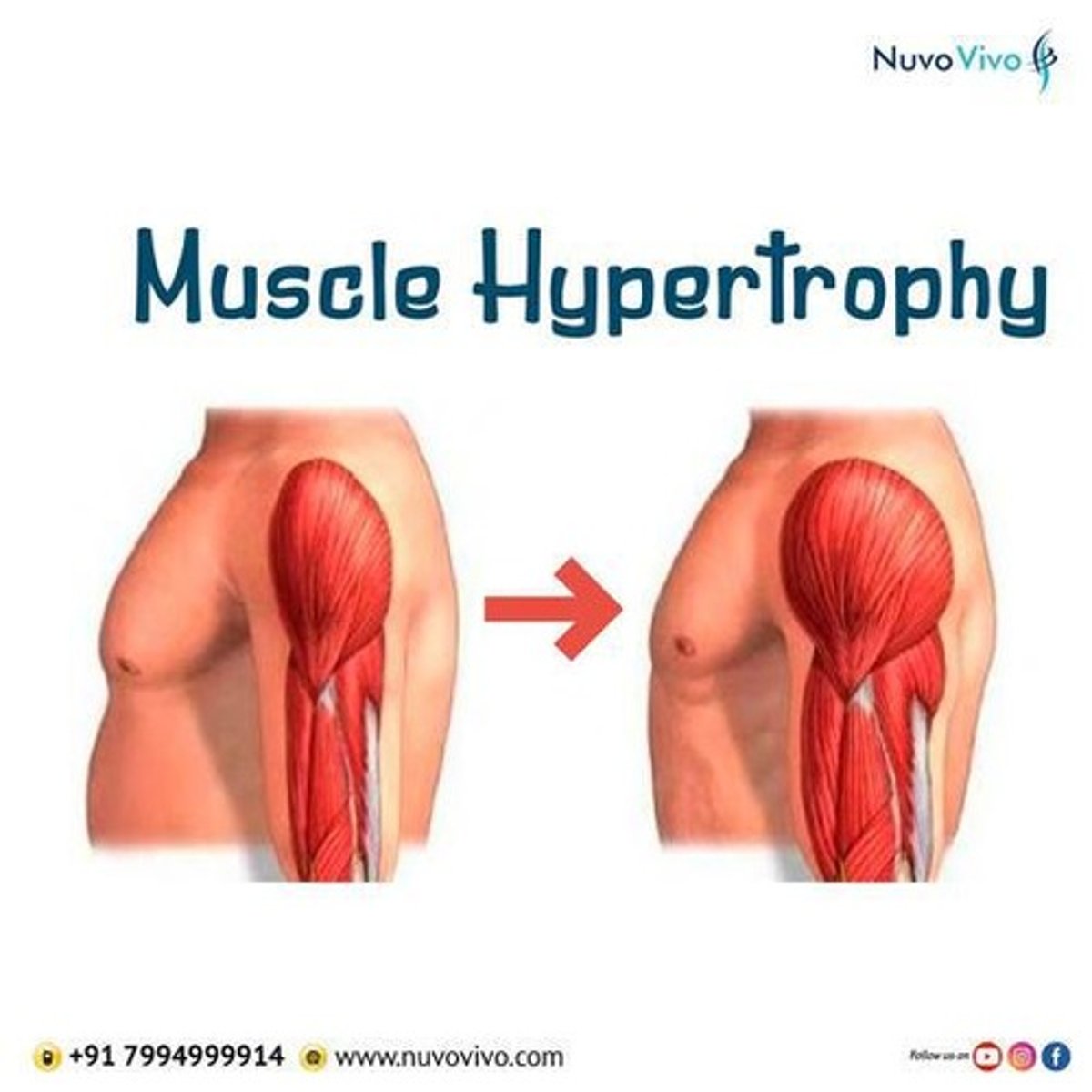 <p>Strength training results in muscle hypertrophy and increased muscle mass.</p>