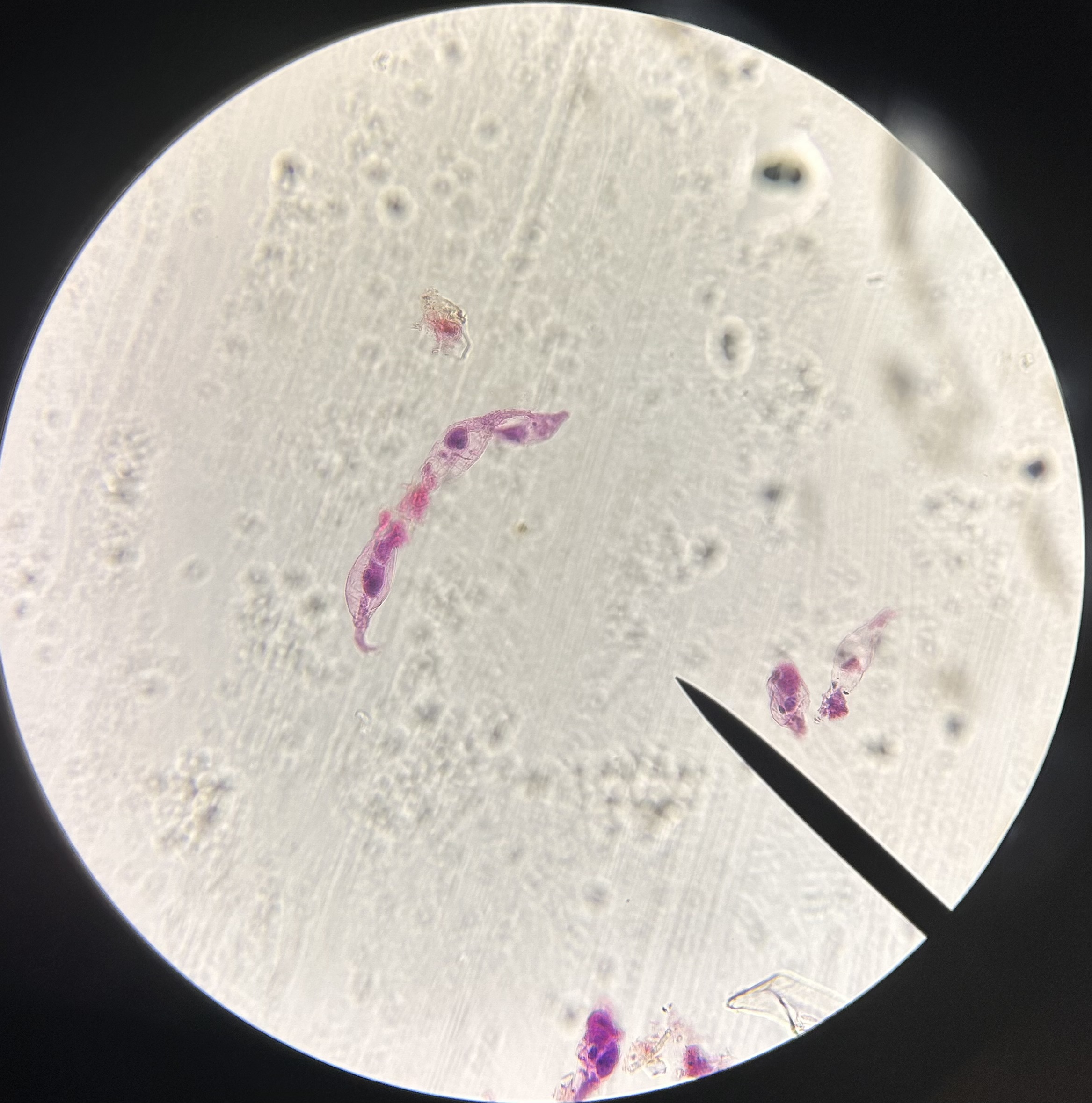 <p>Identify the organism and the Phylum it belongs to</p>