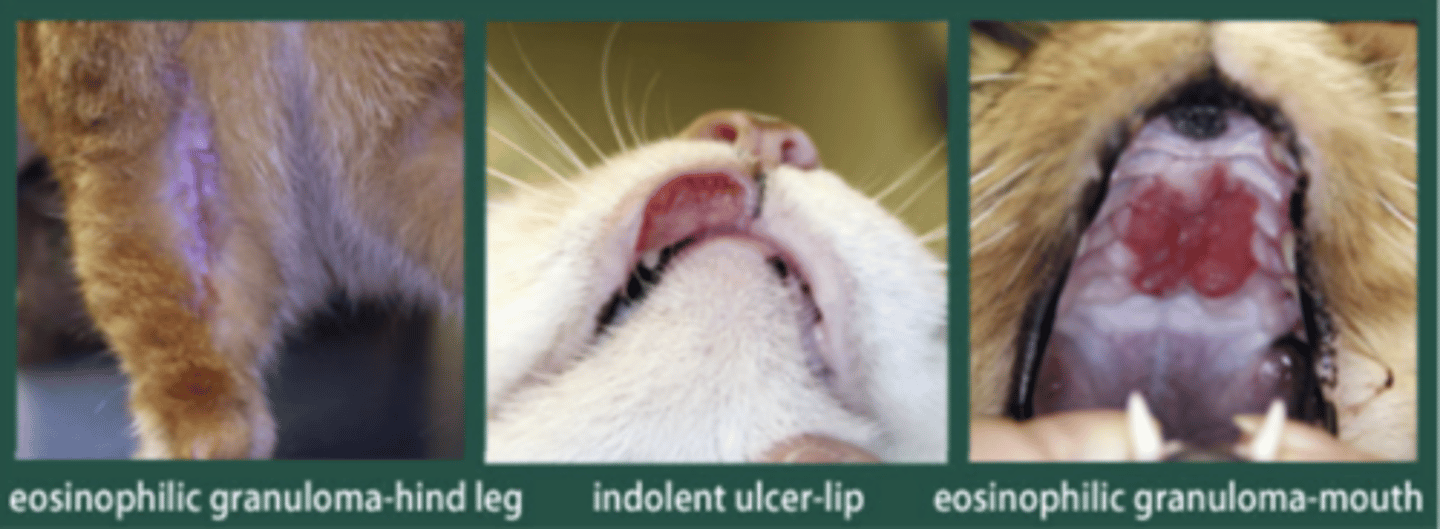 <p>- "Indolent/Rodent ulcers" mainly on the lips, but also on the tongue, palate, gingiva, and pharynx</p>