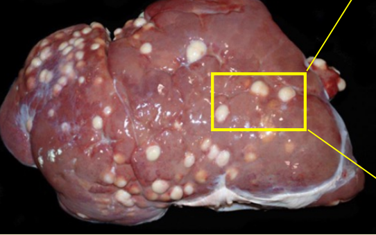 <p>What type of chronic inflammation does this image show?</p>