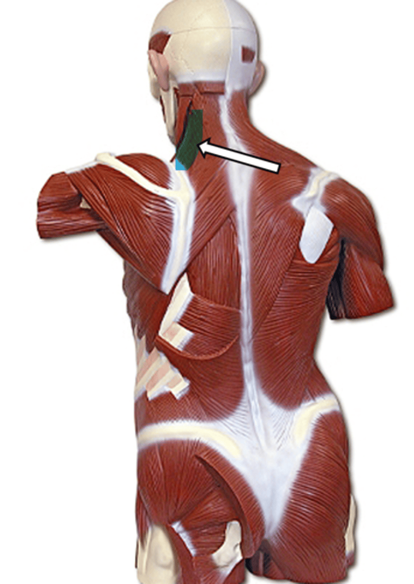 <p>name the muscle</p>