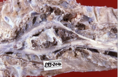 <p>What condition has this calf got in its spinal cord?</p>