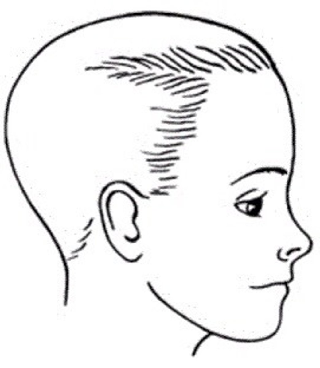 <p>Slightly protruded jaws, facial outline is relatively flat appearance</p>