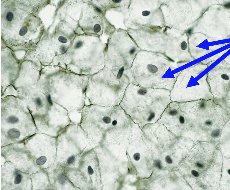 <p>What is the arrow point at?</p>