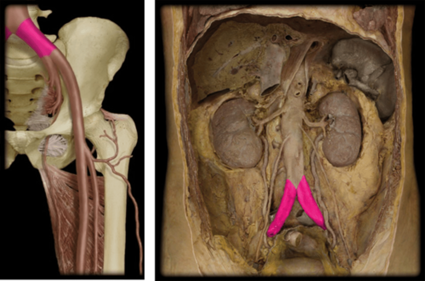 <p>Name these vessels.</p>