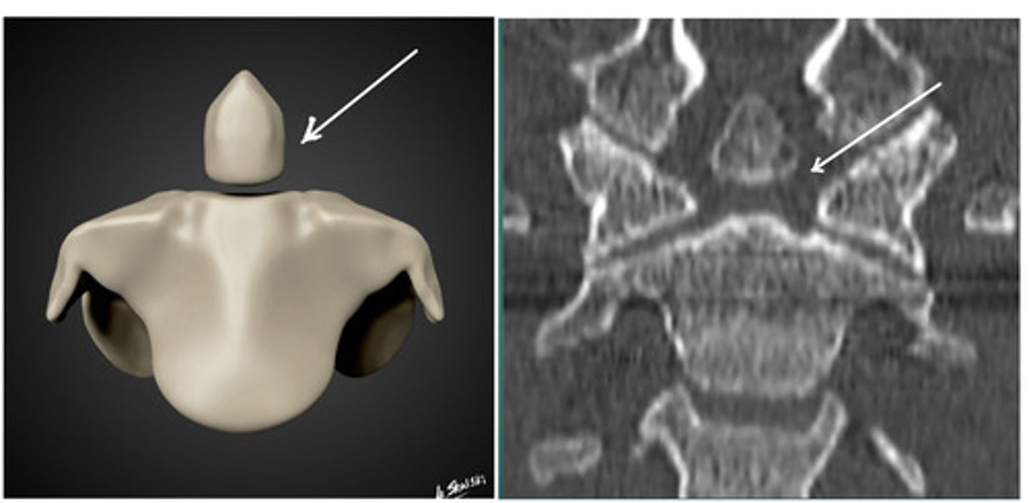 <p>What anomaly is this?</p>