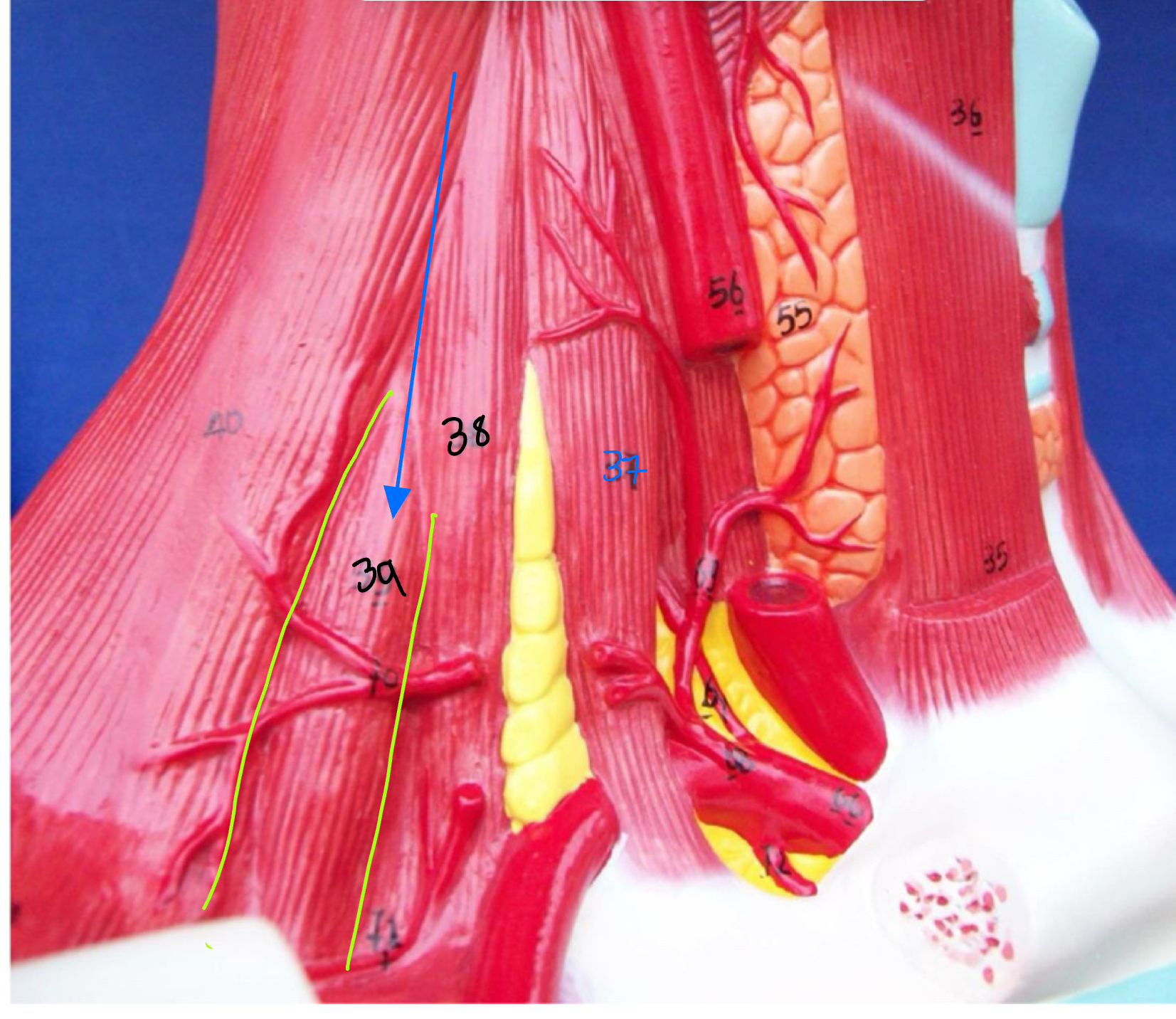 <p>What type of muscle is this ( altay model )</p>