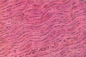 <p>Identify the tissue</p>