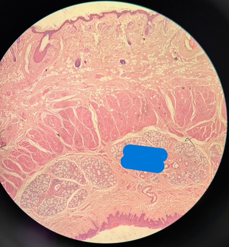 <p>Organ?</p>