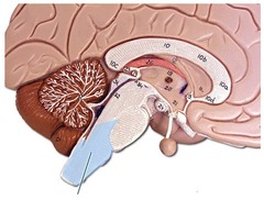 identify the image