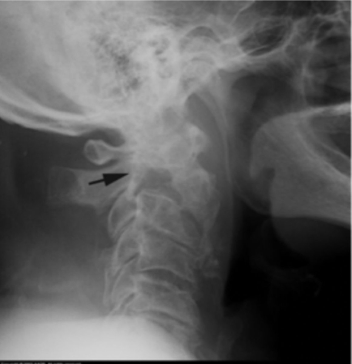 <p>What is the issue?</p>