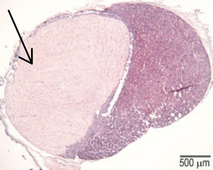 Posterior lobe (pituitary gland)