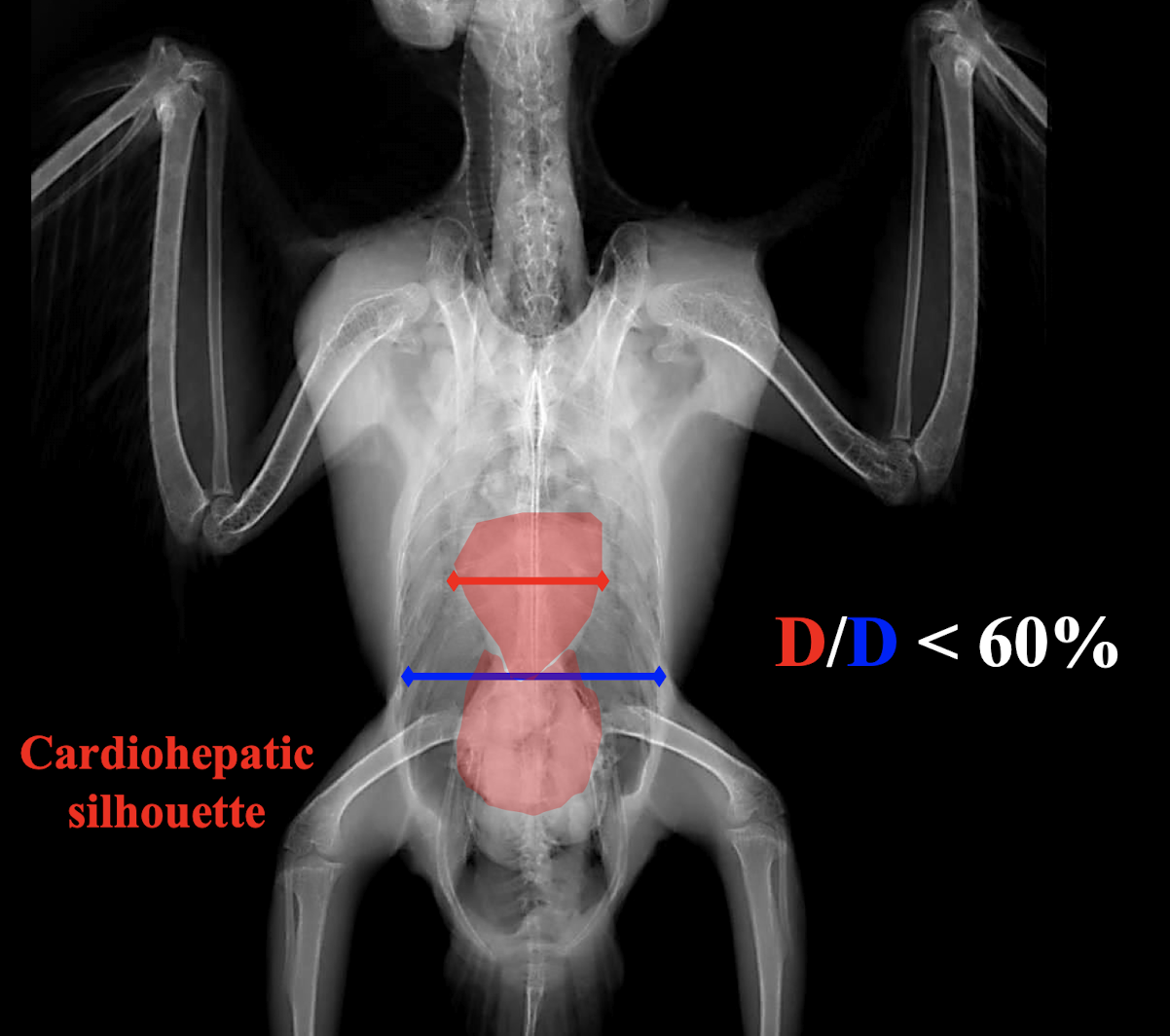 <p>Less than 60% of the thoracic width.</p>