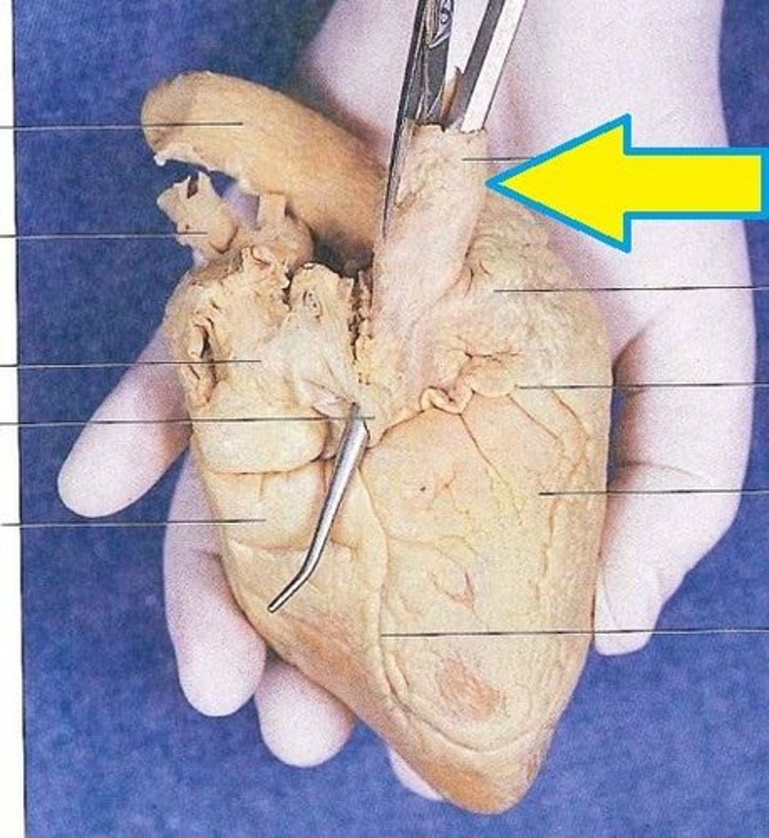 <p>opening; tip of probe, posterior side, smaller opening at top</p><p>H6</p>