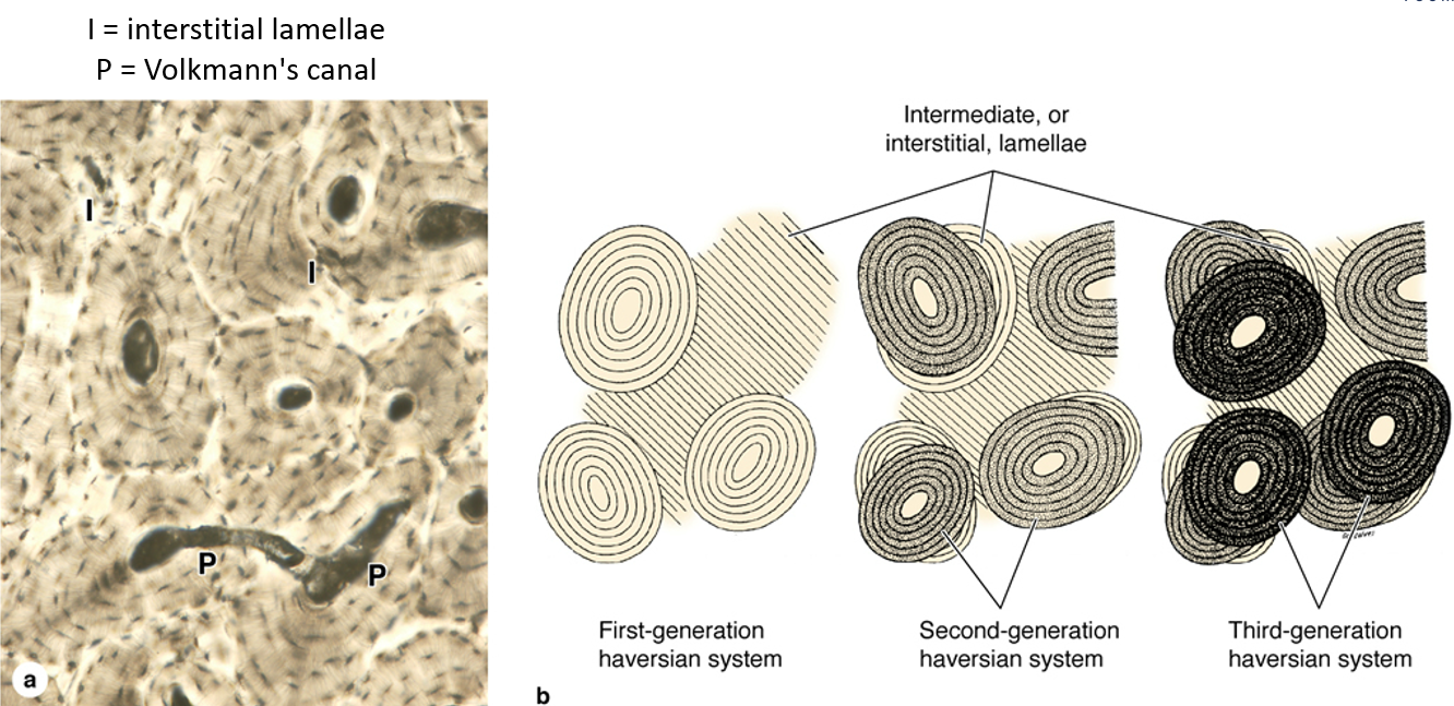 <p><strong>Remnants of old osteons</strong> found between newer osteons in <strong>compact bone</strong>. They help maintain bone structure and fill spaces between osteons</p>