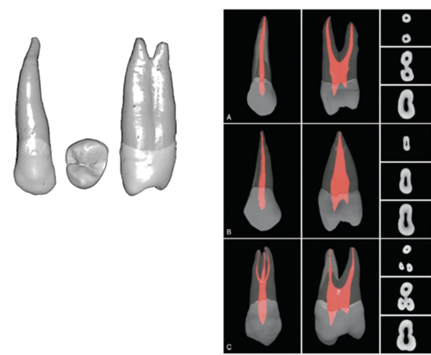 <p>maxillary 1st premolar</p>