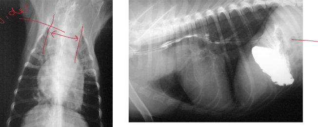 <p>Is this a normal mediastinum?</p>