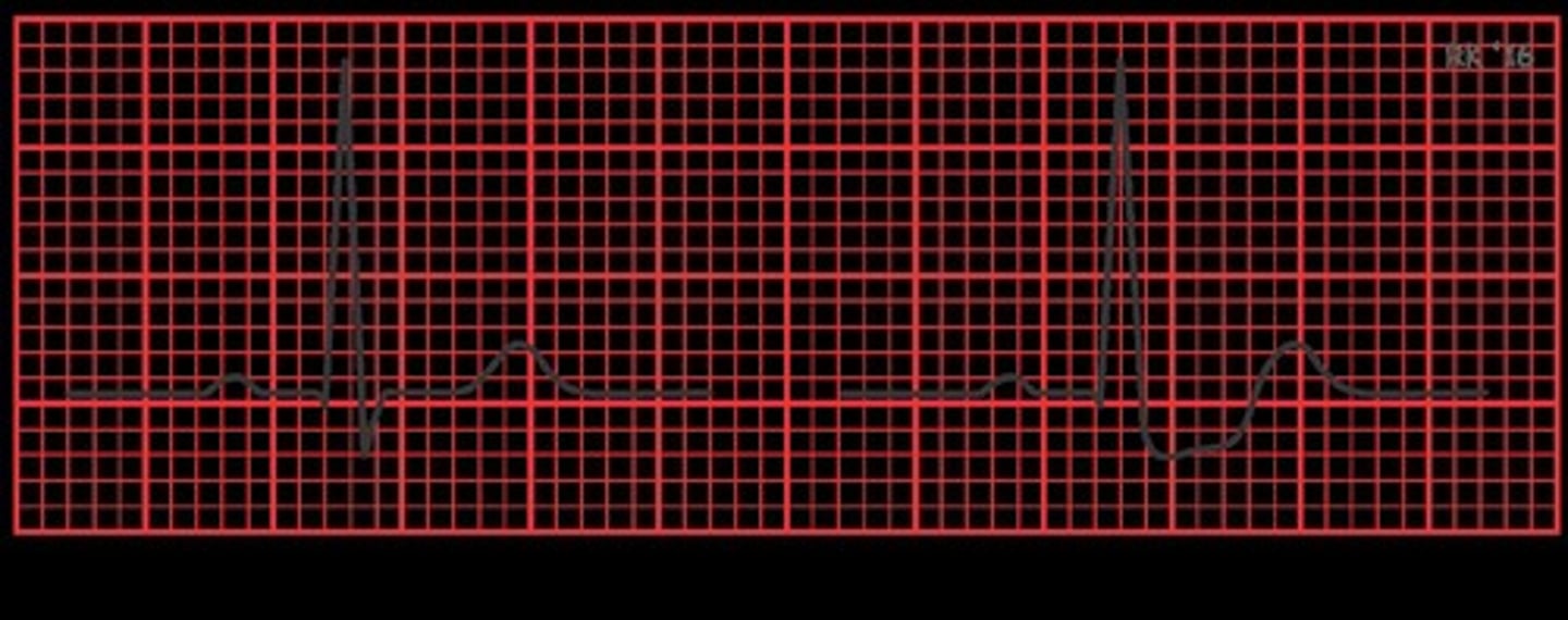 <p>Measures electrical activity of the heart.</p>