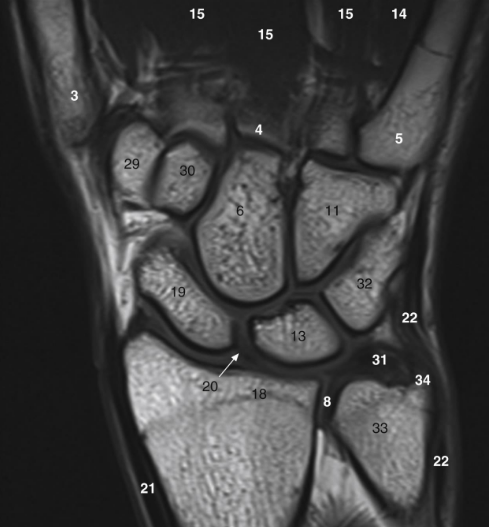 <p>What is 31</p>