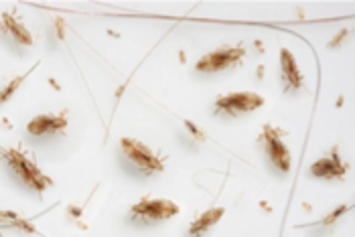 <p>Parasitic ID:</p><p>Overview:</p><p>- Pediculosis capitis</p><p>- Caused by infestation of hair and scalp by Pediculus humanus capitis (head louse)</p><p>- Children most often affected</p><p>Eggs (“nits”) = oval capsules that hatch in 8 days, releasing nymphs that require another 8 days to mature</p><p>- After hatching, egg cases become white and more visible</p><p>Adult these are equipped with mouthparts adapted to sucking blood and legs adapted to grasping hair</p><p>- Primary mode of transmission: contact with head of infested person</p><p> do not jump, fly, or use pets as vectors</p>