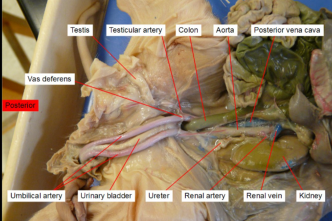 <p>A coiled tube that carries the sperm out of the testes.</p>
