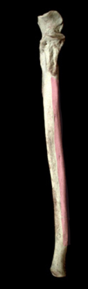 <p>What structure is this?</p>