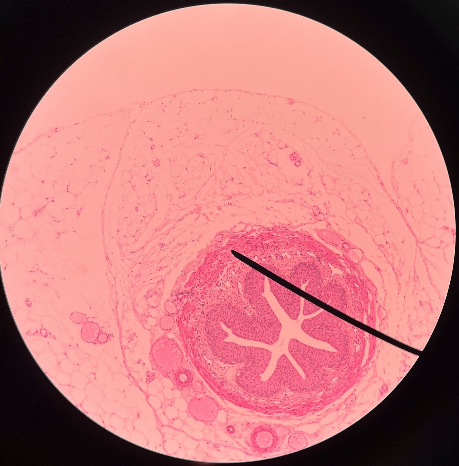 • Slide histology of the ureter.

• A smooth muscle layer of the ureter.

• Superficial to the longitudinal layer of the muscularis and deep to the adventitia.