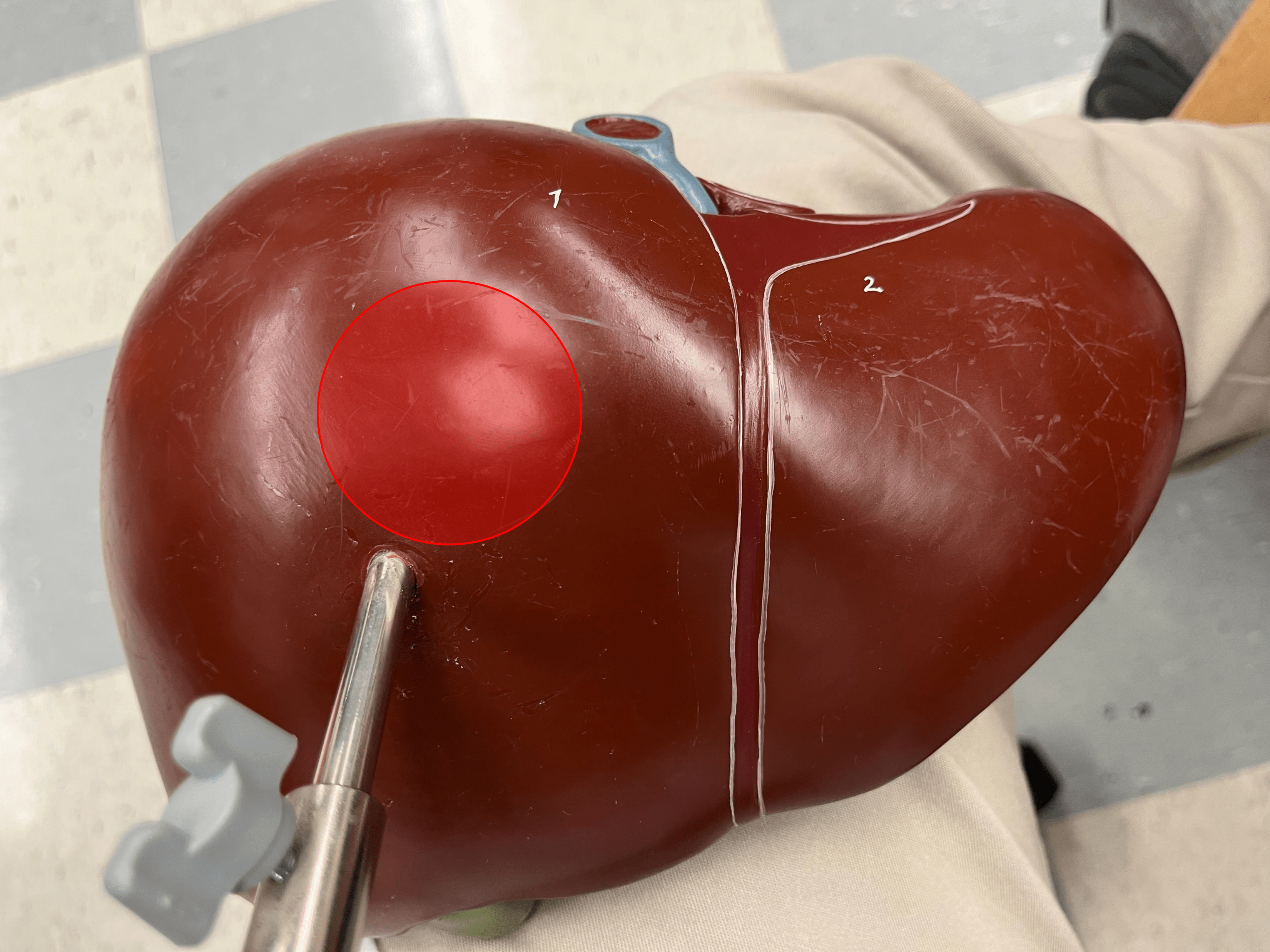 • A lobe of the liver.

• The larger lobe on the anterior of the liver.