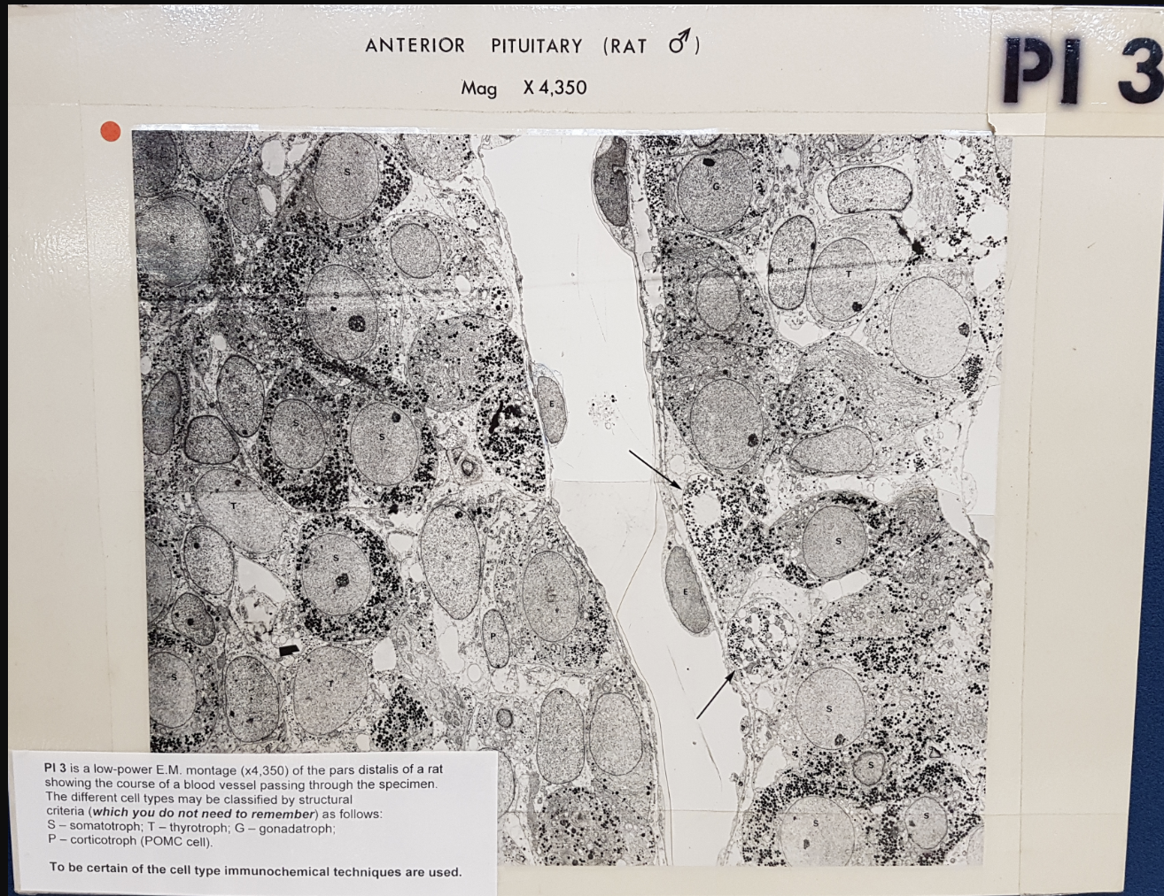 <ul><li><p>Various endocrine cell types</p></li><li><p>course of blood vessels passing through specimen</p></li></ul><p></p>