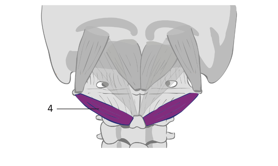 <p>what muscle is this </p>