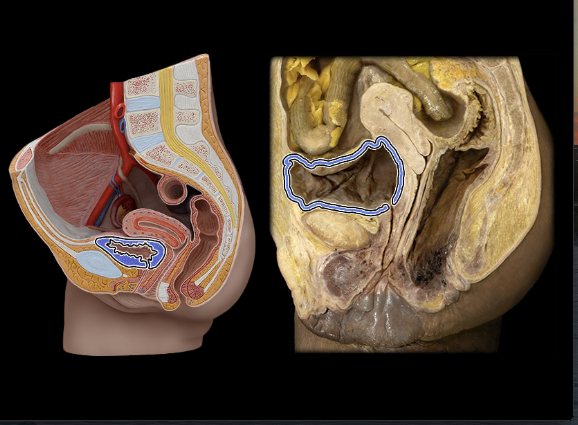 <p>Middle layer of urinary bladder</p>