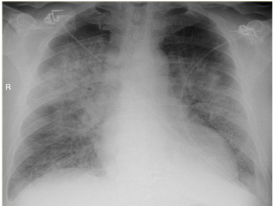 <p>whats the dx?</p>