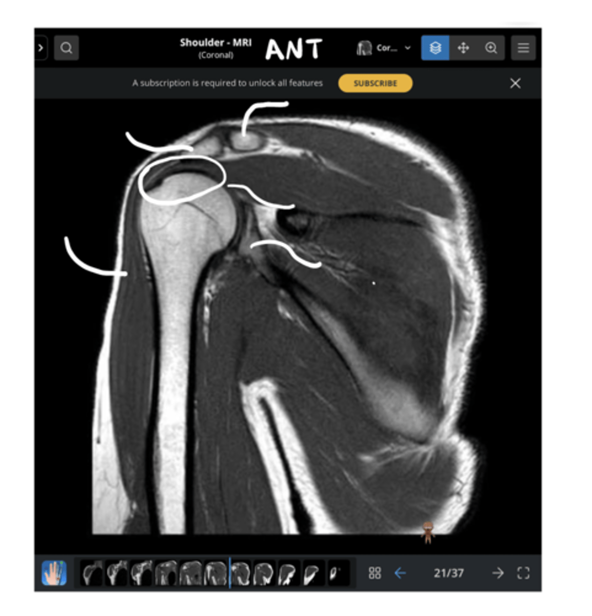 <p>Working our way around clockwise, which structures are being pointed to?</p>