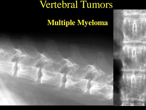 <ul><li><p><strong>Primary tumors: stops growing when pet stops growing</strong></p><ul><li><p>usually located in only <strong>one vertebral body</strong></p><ul><li><p>E<u>xcept Osteochondroma or multiple cartilaginous exostoses</u></p><ul><li><p>Multiple vertebrae and/or ribs</p></li></ul></li></ul></li><li><p>Most are <strong>lytic</strong></p></li><li><p><strong><u>Osteosarcoma</u></strong> is most common</p></li></ul></li><li><p><strong>Metastatic Tumors</strong></p><ul><li><p><strong>multiple</strong> vertebral bodies</p><ul><li><p>tumors through body</p></li></ul></li><li><p>lytic or periosteal</p></li></ul></li><li><p><strong>RS</strong></p><ul><li><p>osteolytic or osteoblastic lesions, compression</p></li><li><p><strong>MM:</strong> multiple areas of <strong>moth-eaten diffuse lysis</strong></p></li><li><p><strong>MCE: </strong>bony mass displacing and compressing the Spinal cord</p></li></ul></li></ul><p></p>