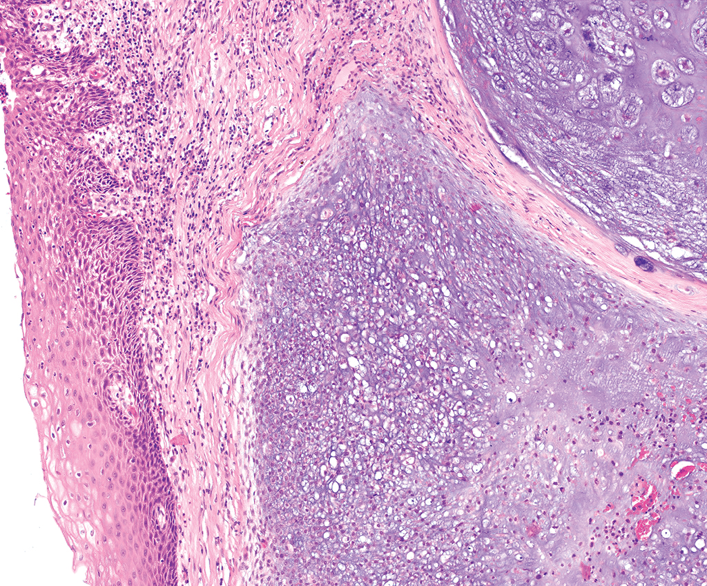 <p>Tumeur de la mandibule </p><p>1) Diagnostic </p><p>2) Clinique </p><p>3) histologie</p><p>4) IHC</p><p>5) moléculaire </p><p>6) DD </p>