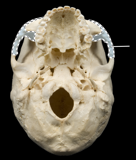 <p>Name this bone.</p><p>(Skull, inferior view).</p>