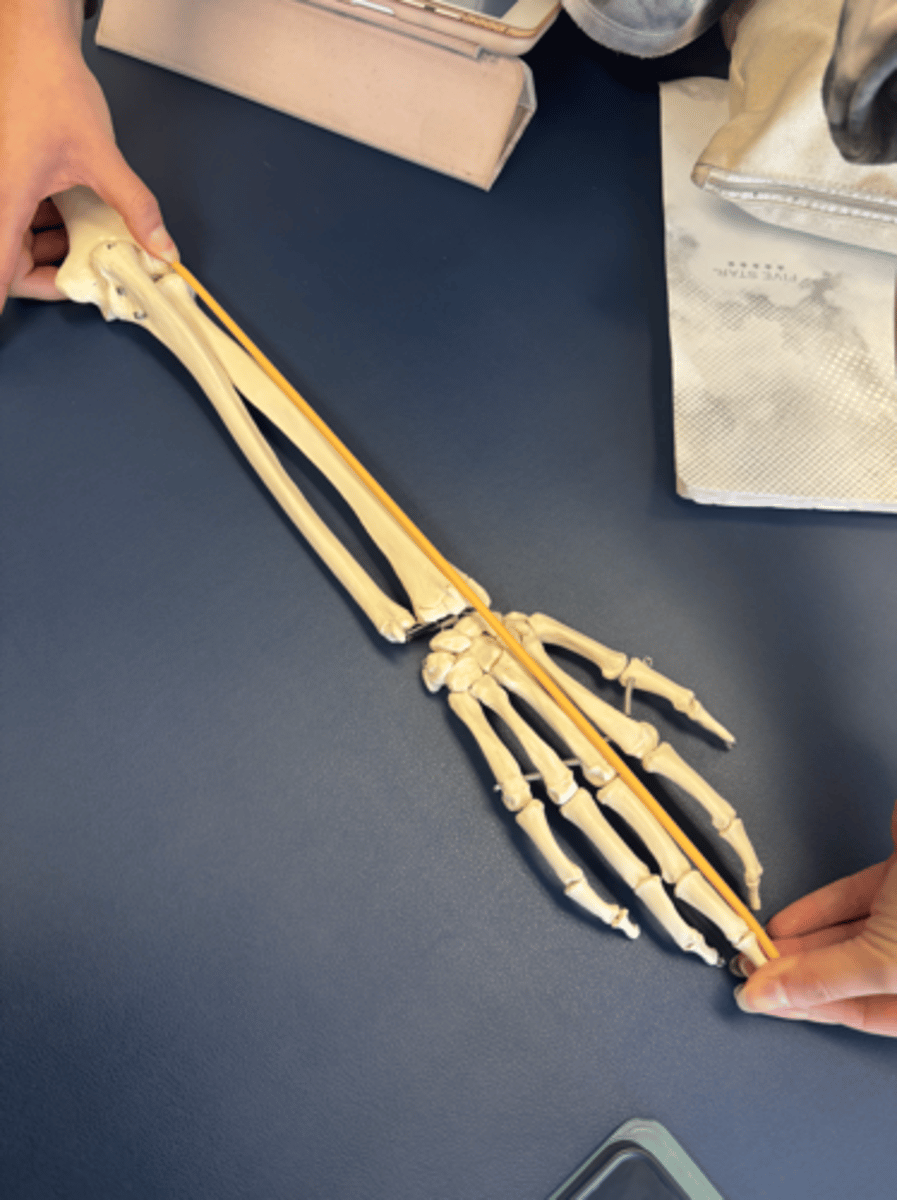 <p>What is this muscle?</p>