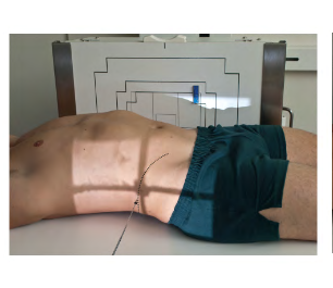 <p>What Position is this? ( Look how patient is with IR ) </p><ul><li><p>Laying supine with <strong>Horizontal</strong> beam </p></li></ul><p></p>