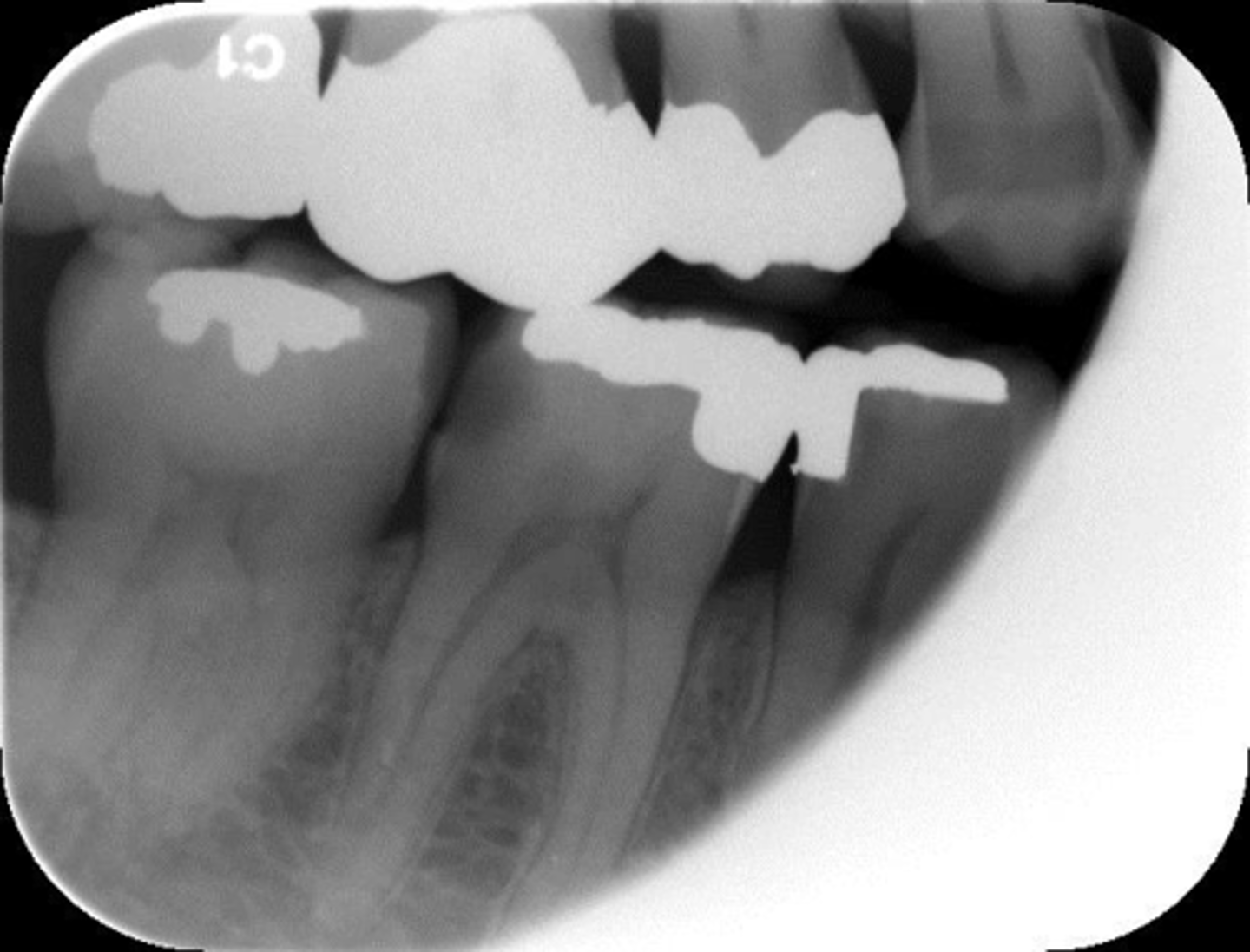 <p>What is this error?</p>