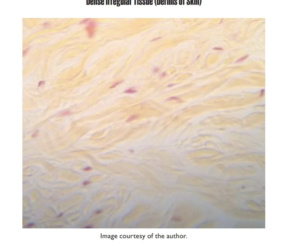 <p>Dense Irregular Tissue </p>