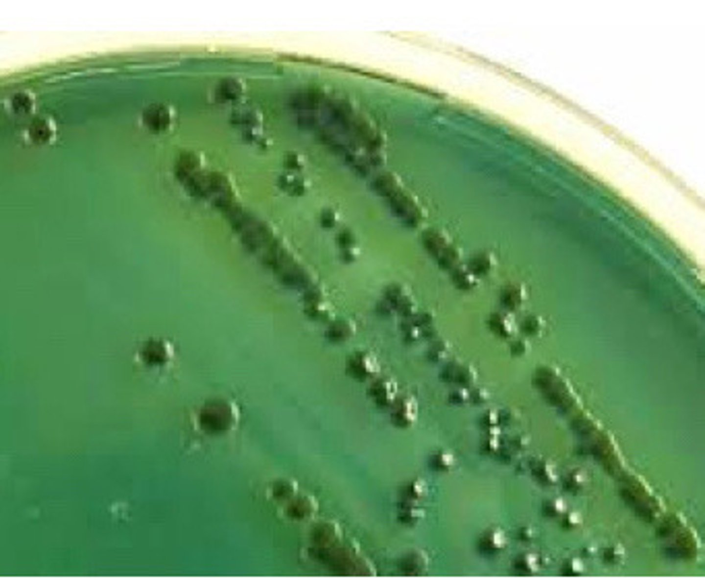 <p>GNB, found in oysters, susceptible O129 10ug disc, cause necrotising fasciitis in wounds</p>