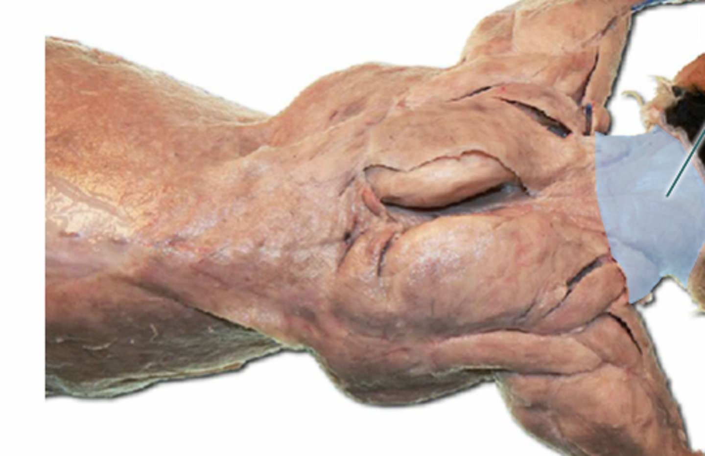 <p>name this muscle</p>