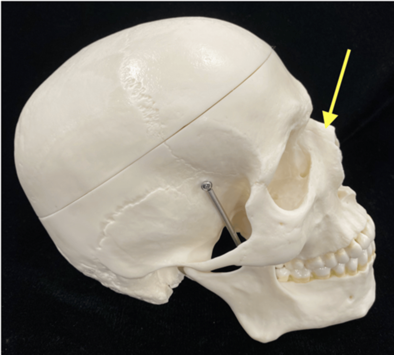 <p>name the bone </p>